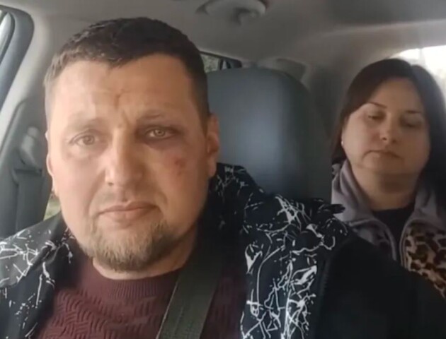 Жорстоке побиття ветерана в Луцьку: у ТЦК прокоментували скандал