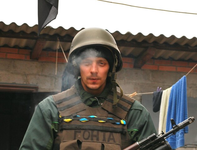 «Це наслідок війни». Військовослужбовцю з Волині потрібна допомога