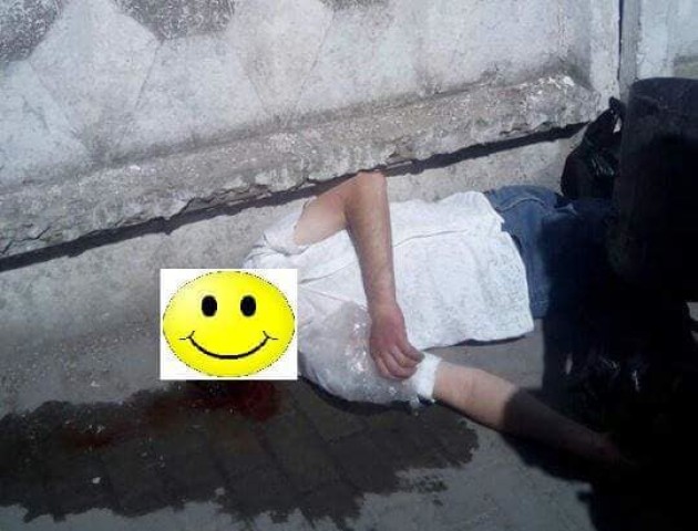Луцькі муніципали врятували чоловіка, який упав і розбив голову