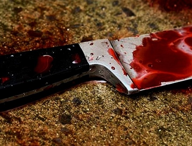На Волині під час сімейної сварки чоловік порізав зятя