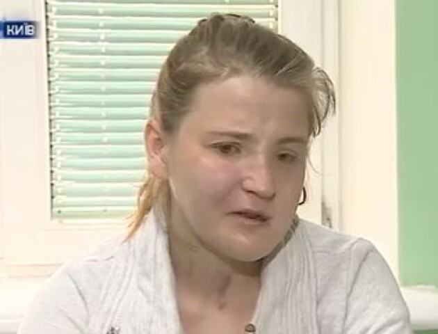 Повернути втрачену красу. 19-річній Іванці Гаджало збирають гроші на нову операцію