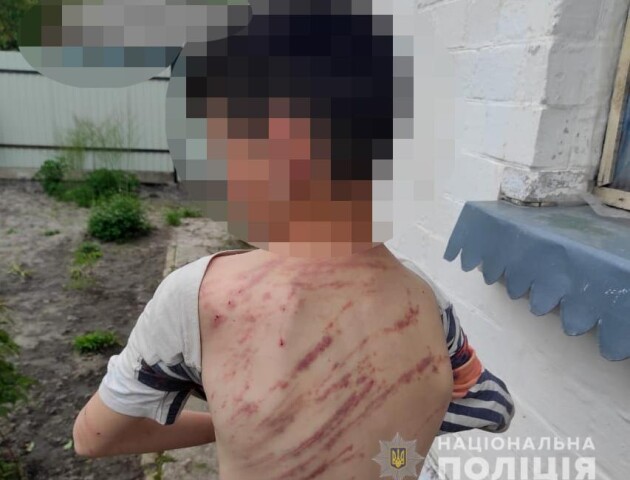 Вдарив гілкою 20 разів: у Володимирі вітчим побив 13-річного хлопця за непослух