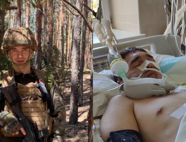 Пораненому снайперу з Луцька потрібна допомога