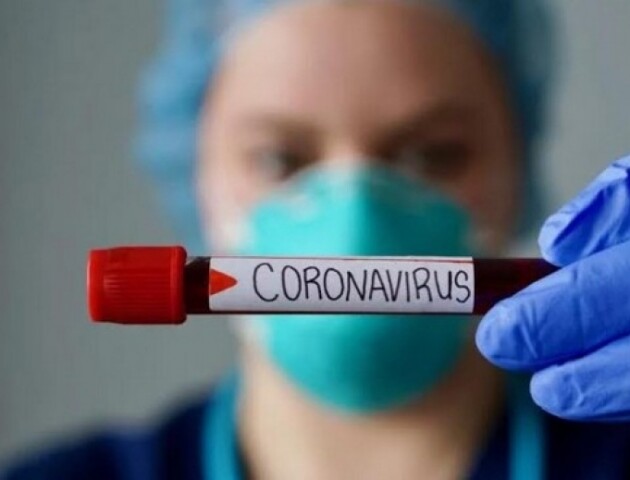 Якщо піде за сценарієм Італії, матимемо тисячу тяжких хворих на Волині, - очільник обласної лікарні