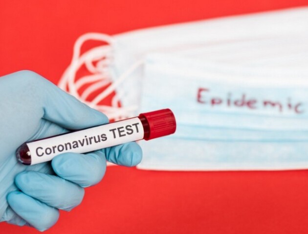 За добу в Україні ще у 809 людей виявили COVID-19. Тих, хто одужав, – більше