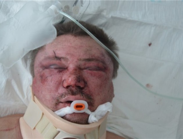 На Волині шукають родичів важко травмованого чоловіка. ФОТО 18+