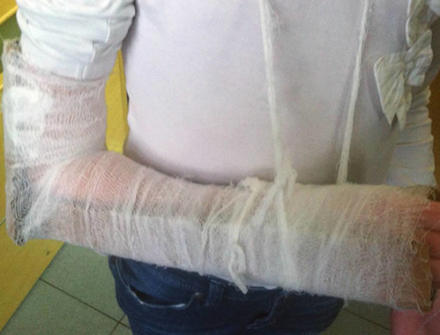 Що і як часто ламають лучани