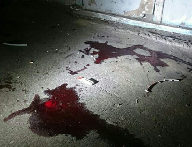 У Києві 16-річний хлопець помер у муках на очах у власних батьків