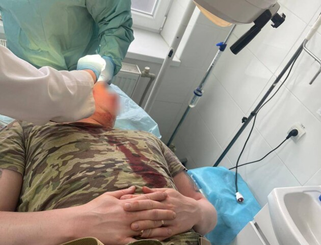 Кидали цеглою: люди напали на прикордонників. ФОТО 18+