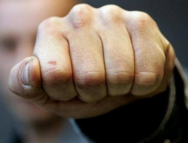 На Волині жінка терпіла болі після побоїв і померла