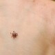 У двох волинян виявили хворобу Лайма після укусів кліщів