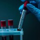 Коронавірус в Україні: 507 нових хворих та 20 смертей