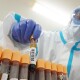 В Україні за минулу добу виявили 756 хворих на коронавірус