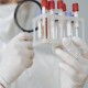 Чому ПЛР-тести можуть давати хибний результат? Пояснення лікарів