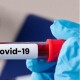 Коронавірус в Україні: 2 477 хворих та 44 смерті