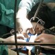 У Волинській обласній лікарні проводитимуть пересадження органів