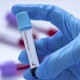 Коронавірус в Україні: 6 754 хворих та 105 смертей