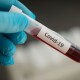 В Україні торгують довідками про відсутність COVID-19 для виїзду за кордон, – директор лабораторії