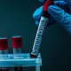 Хто з хворих на COVID-19 підлягає обов'язковій госпіталізації? Пояснення МОЗ