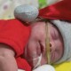 Новонароджені «Санти». У Луцьку в перинатальному центрі влаштували сюрприз батькам