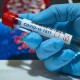 За минулу добу коронавірус виявили у 628 волинян