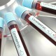 У Старовижівському районі померла жінка, інфікована коронавірусом