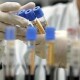Тест на коронавірус безкоштовно робитимуть приватні лабораторії. Степанов розповів подробиці