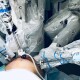 «У Львові оперує робот». Лікар з Волині розповів про унікальну операцію
