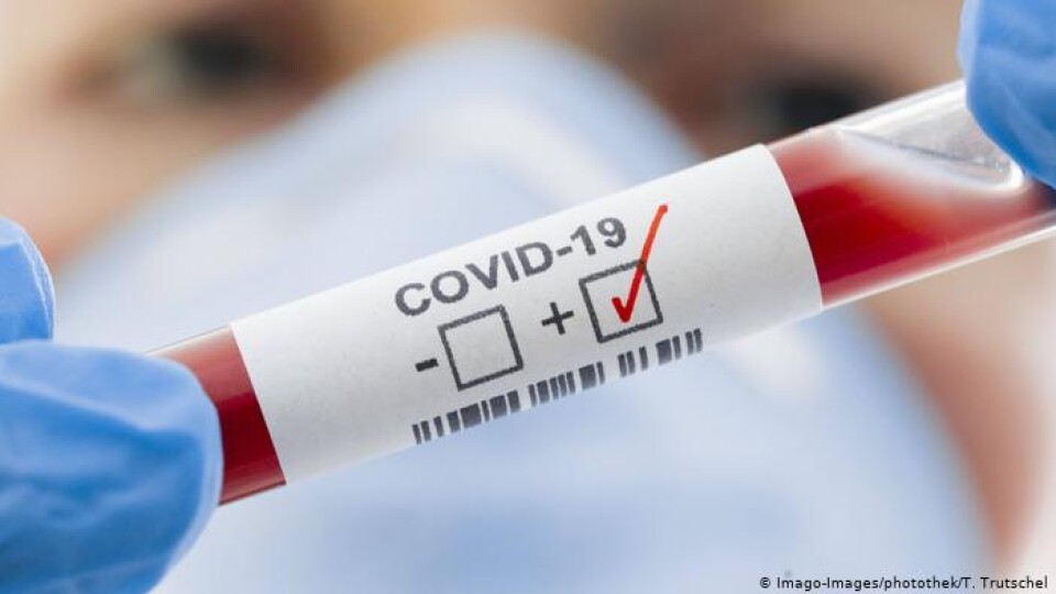 Коронавірус в Україні: 857 нових хворих та 33 смерті