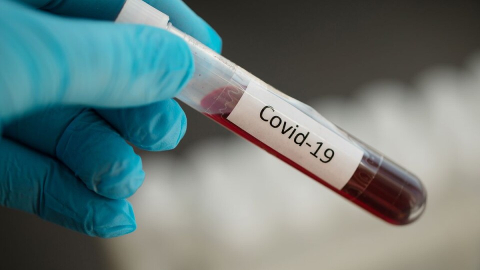 В Україні торгують довідками про відсутність COVID-19 для виїзду за кордон, – директор лабораторії