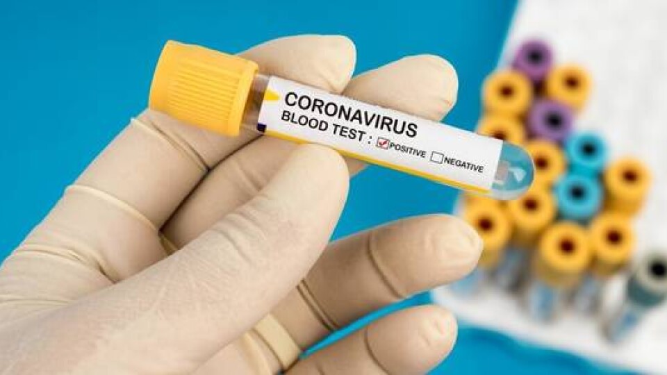 Уряд виділить додаткові кошти на експрес-тести та лабораторії