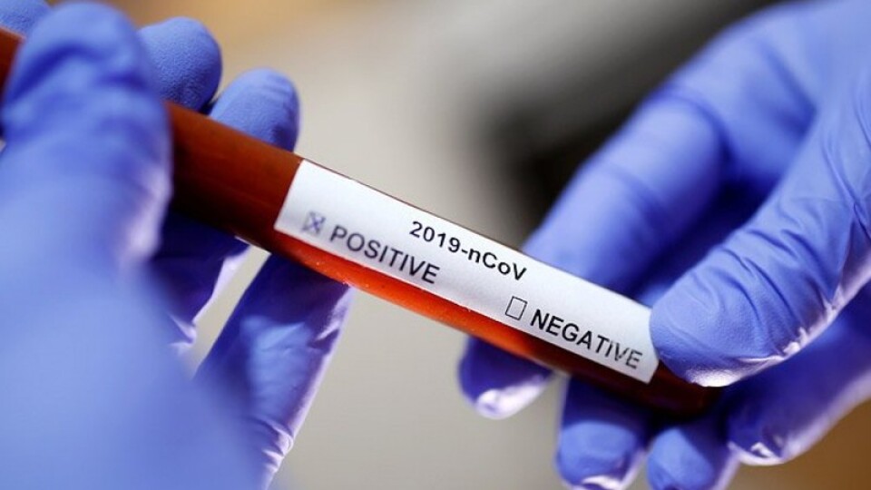Ще у 3 волинян виявили коронавірус за минулу добу