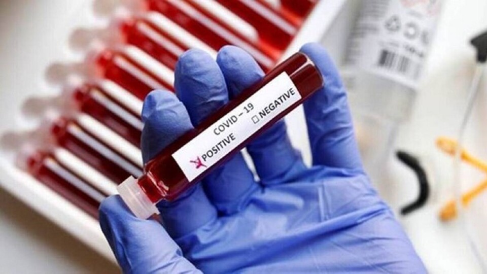 Коронавірус в Україні: 7 283 нових хворих та 387 смертей