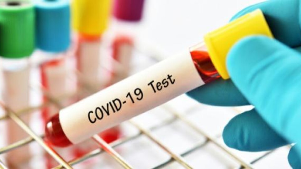 За минулу добу в Україні виявили 15 125 хворих на ковід