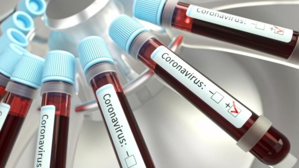 У Старовижівському районі померла жінка, інфікована коронавірусом