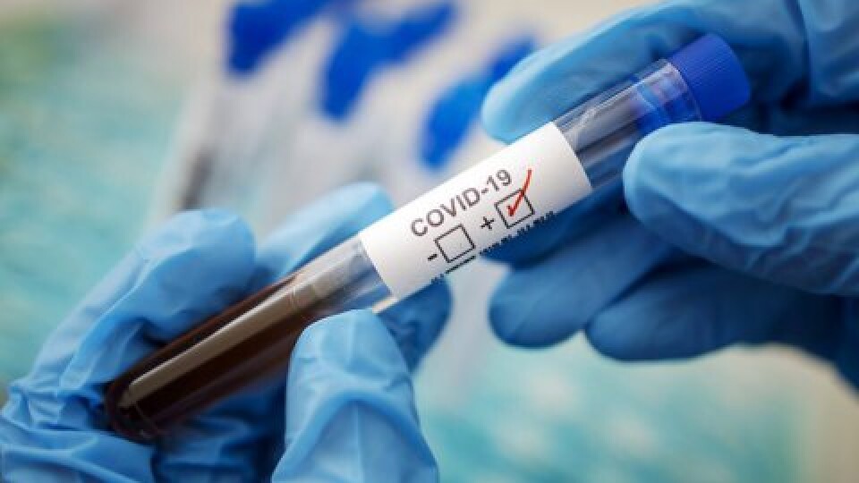 На Волині за добу померло шестеро людей від COVID-19