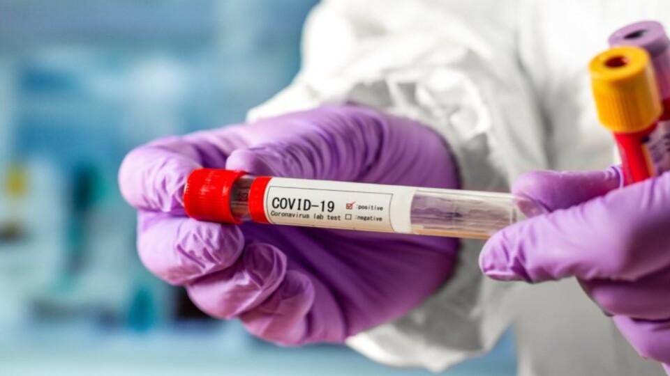 На Волині ситуація з коронавірусом погіршилась, - дані МОЗ
