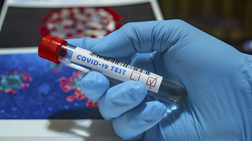 За минулу добу у 8 волинян виявили COVID-19