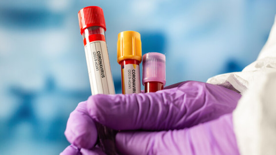 Коронавірус на Волині: 654 нових хворих та 15 смертей