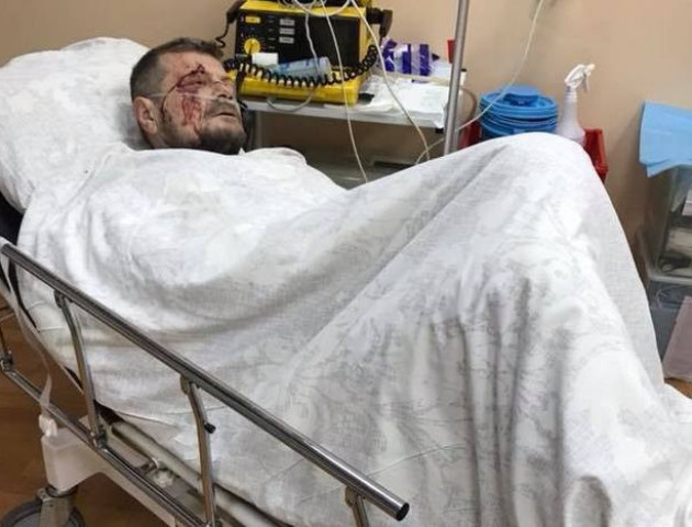 Я пам'ятаю все, – Мосійчук про момент вибуху