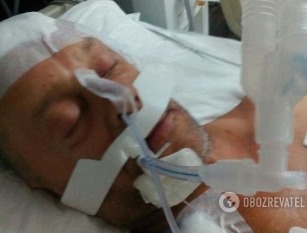 Повідомили, чому у Туреччині росіянин побив до коми українця