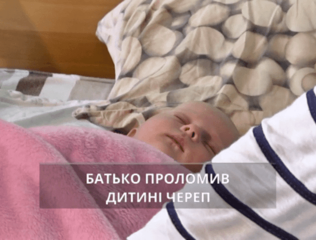 У Рівному батько-грузин влаштував бійку з дружиною і покалічив власну півторамісячну доньку