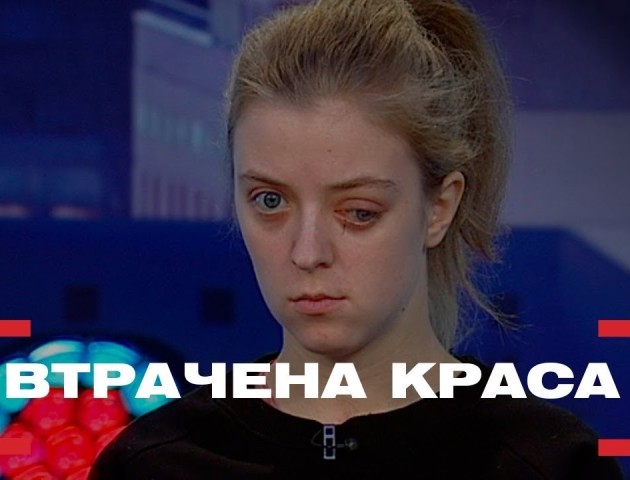 Лікар Валіхновський прооперує волинянку, яка постраждала у страшній ДТП. ВІДЕО